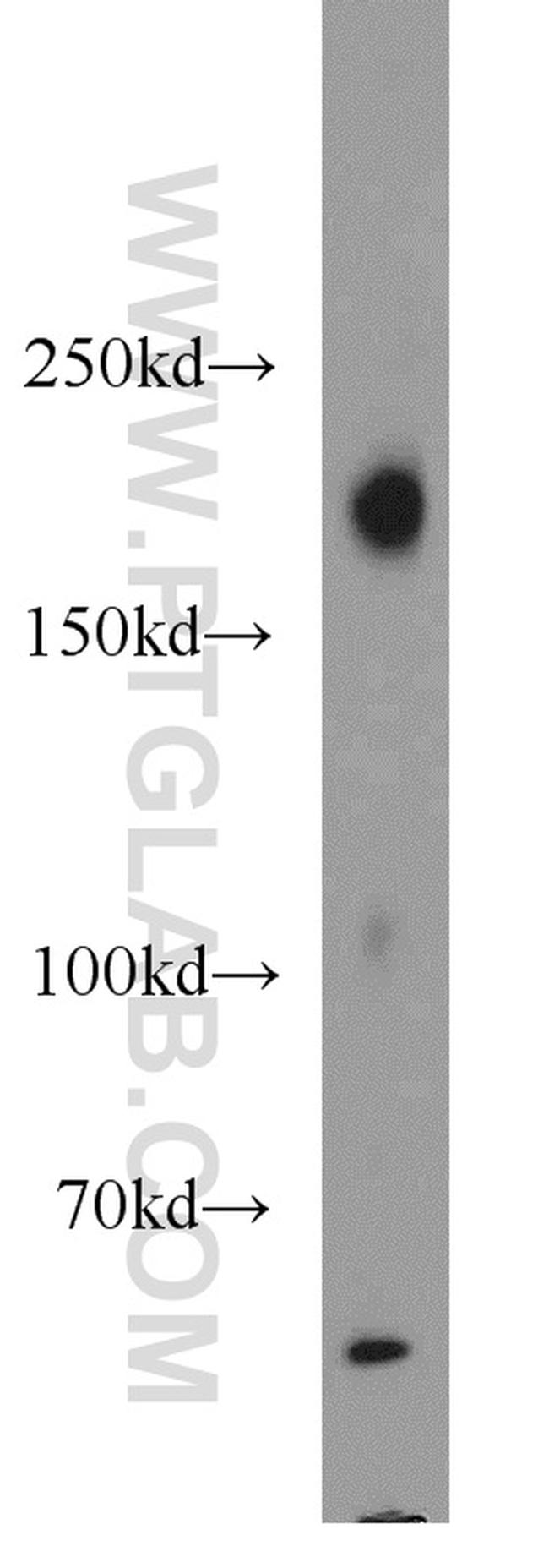 LIFR Antibody in Western Blot (WB)