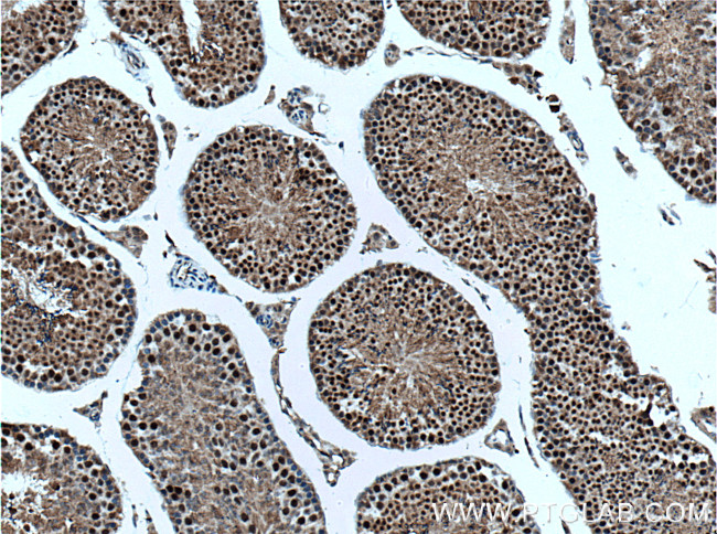 UBR5 Antibody in Immunohistochemistry (Paraffin) (IHC (P))