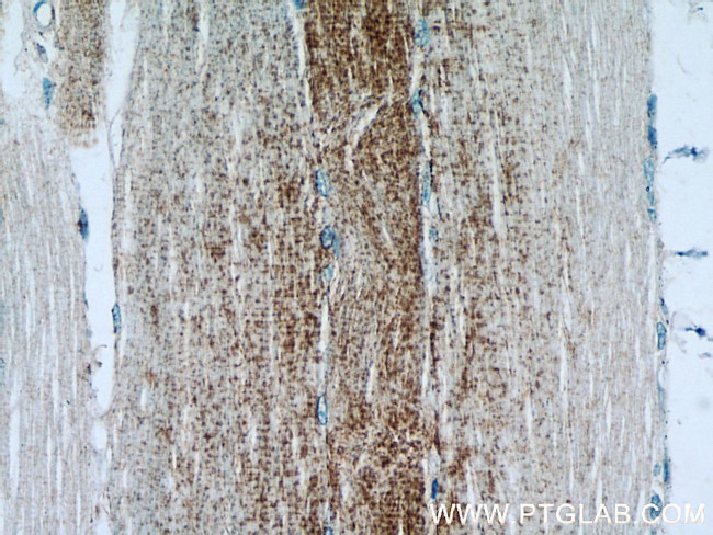 MCT4 Antibody in Immunohistochemistry (Paraffin) (IHC (P))