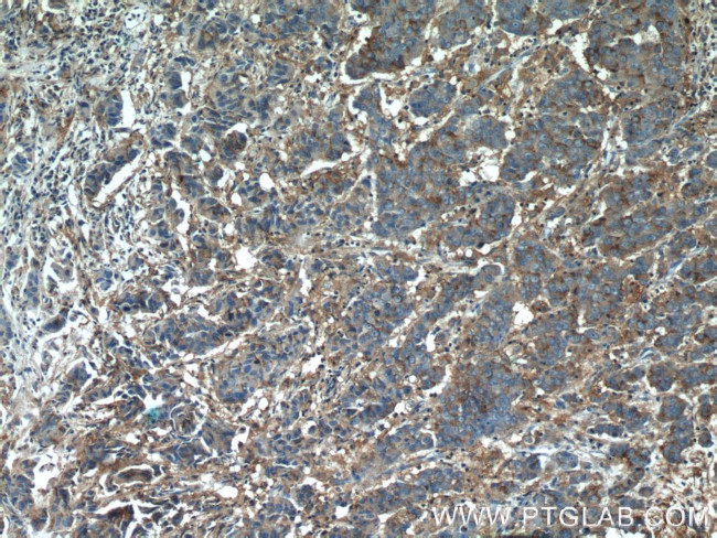 MCT4 Antibody in Immunohistochemistry (Paraffin) (IHC (P))