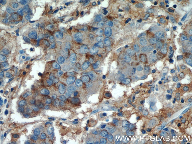 MCT4 Antibody in Immunohistochemistry (Paraffin) (IHC (P))