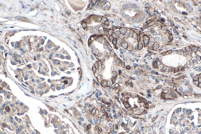 MCT4 Antibody in Immunohistochemistry (Paraffin) (IHC (P))