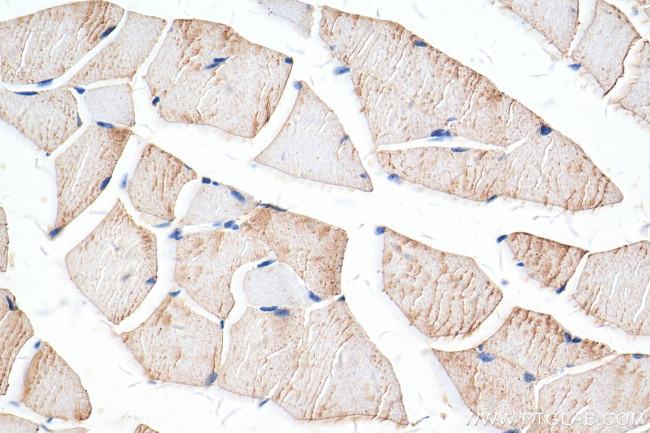 MCT4 Antibody in Immunohistochemistry (Paraffin) (IHC (P))