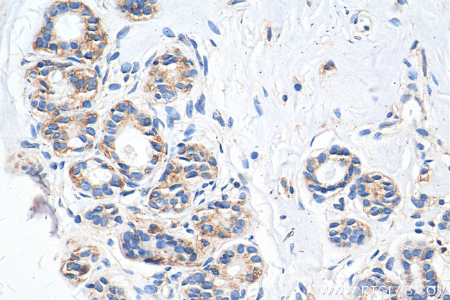 MCT4 Antibody in Immunohistochemistry (Paraffin) (IHC (P))