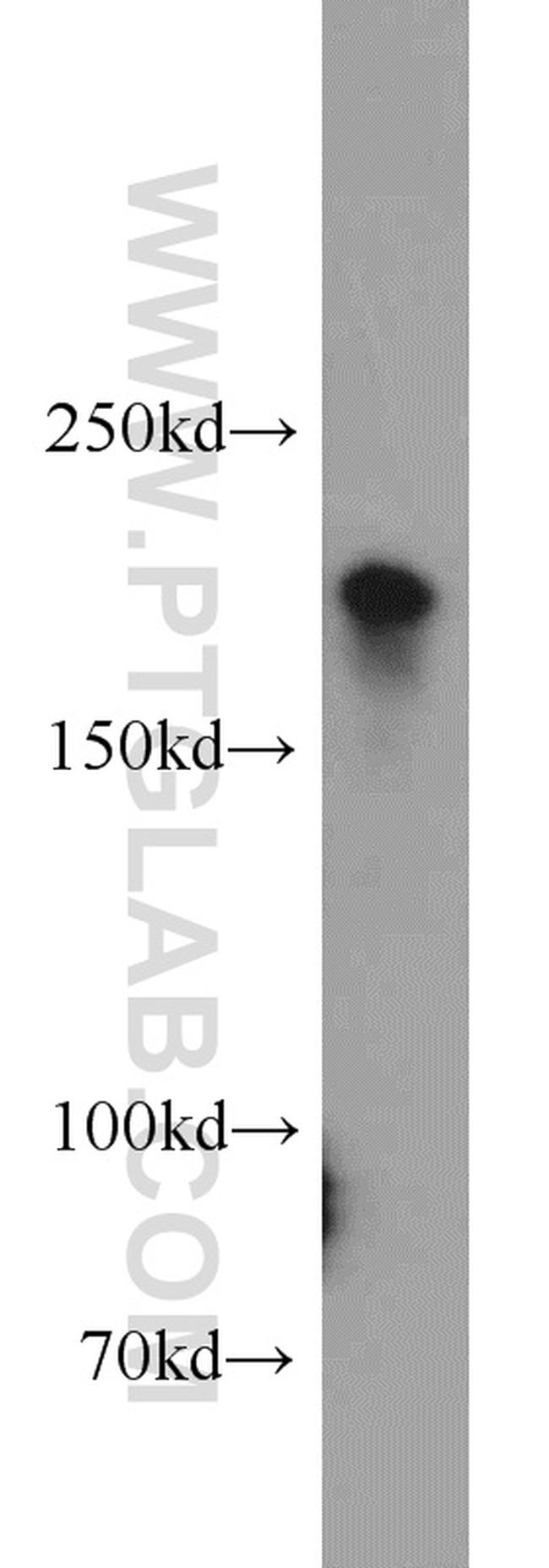 PHLPP Antibody in Western Blot (WB)