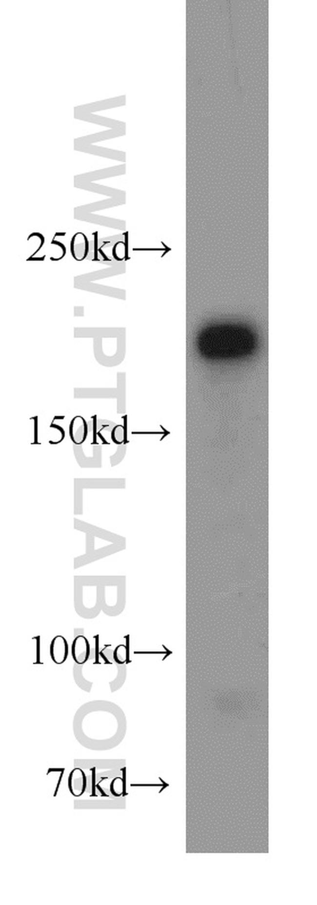 PHLPP Antibody in Western Blot (WB)