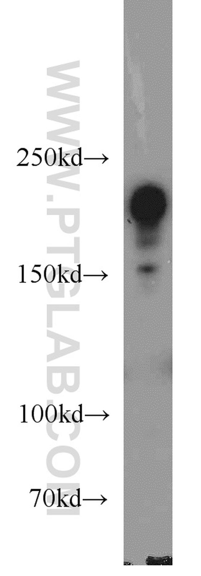 PHLPP Antibody in Western Blot (WB)