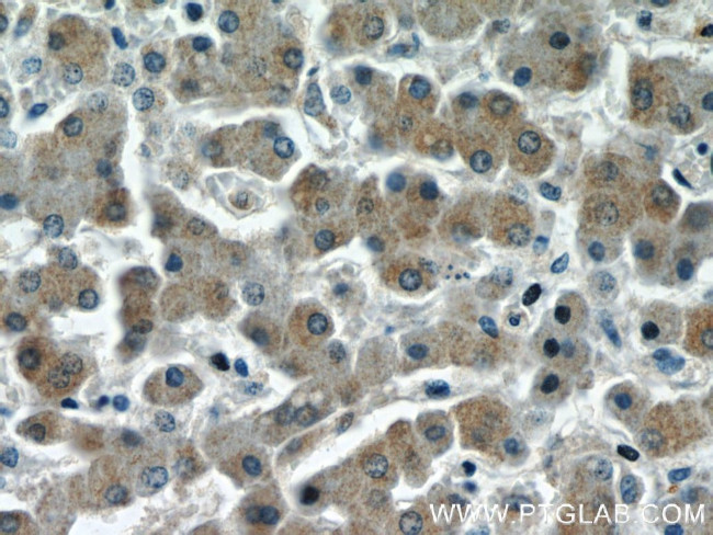 PHLPP Antibody in Immunohistochemistry (Paraffin) (IHC (P))