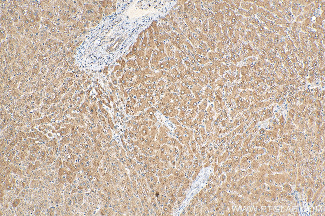 PHLPP Antibody in Immunohistochemistry (Paraffin) (IHC (P))