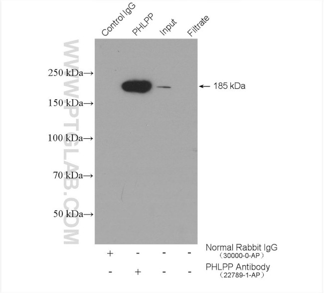 PHLPP Antibody in Immunoprecipitation (IP)
