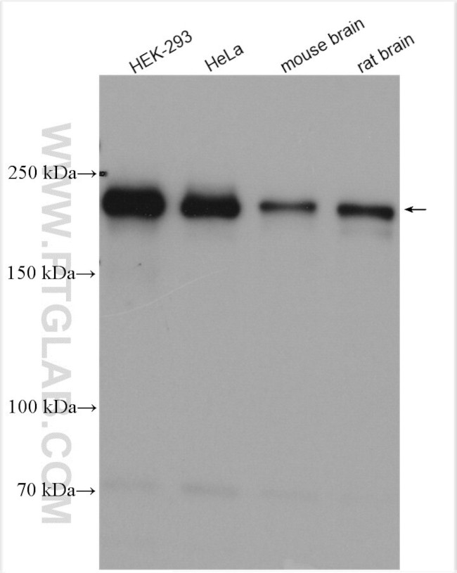 PHLPP Antibody in Western Blot (WB)