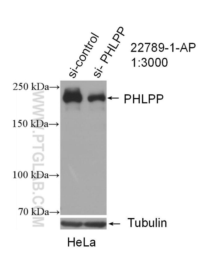 PHLPP Antibody in Western Blot (WB)