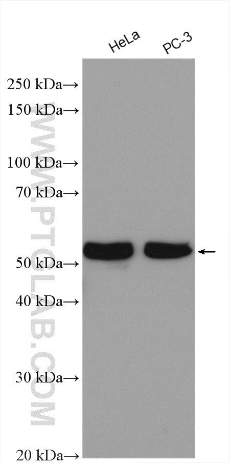 SPAST Antibody in Western Blot (WB)