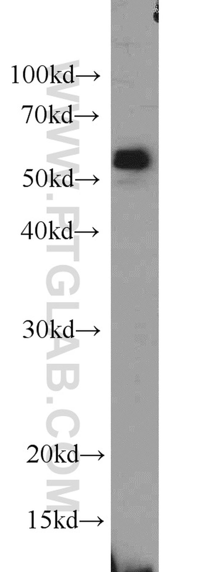 SPAST Antibody in Western Blot (WB)