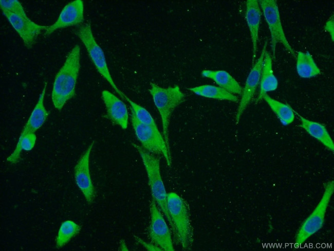 IGF2BP1 Antibody in Immunocytochemistry (ICC/IF)