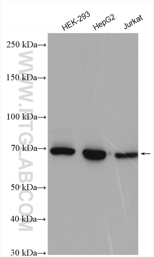 IGF2BP1 Antibody in Western Blot (WB)