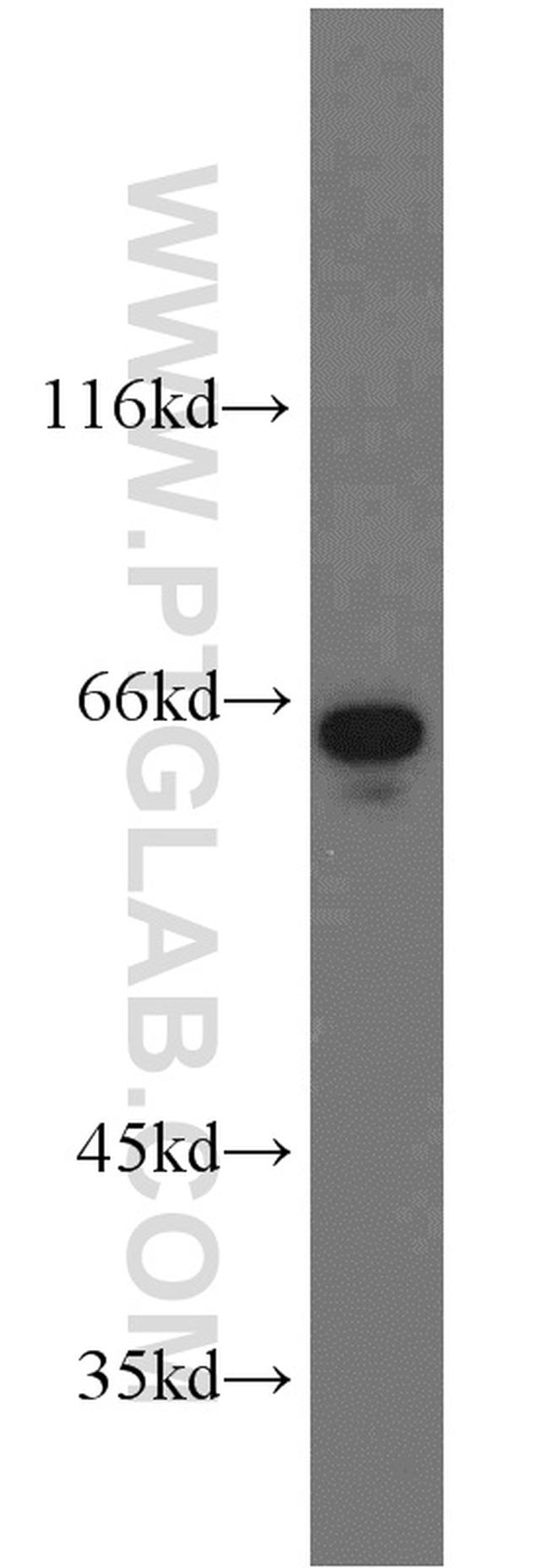 IGF2BP1 Antibody in Western Blot (WB)