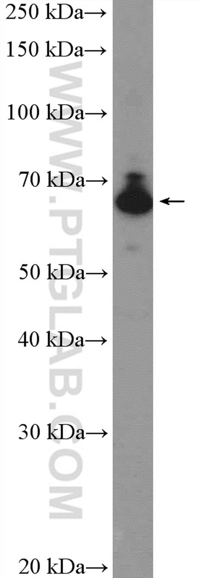 IGF2BP1 Antibody in Western Blot (WB)