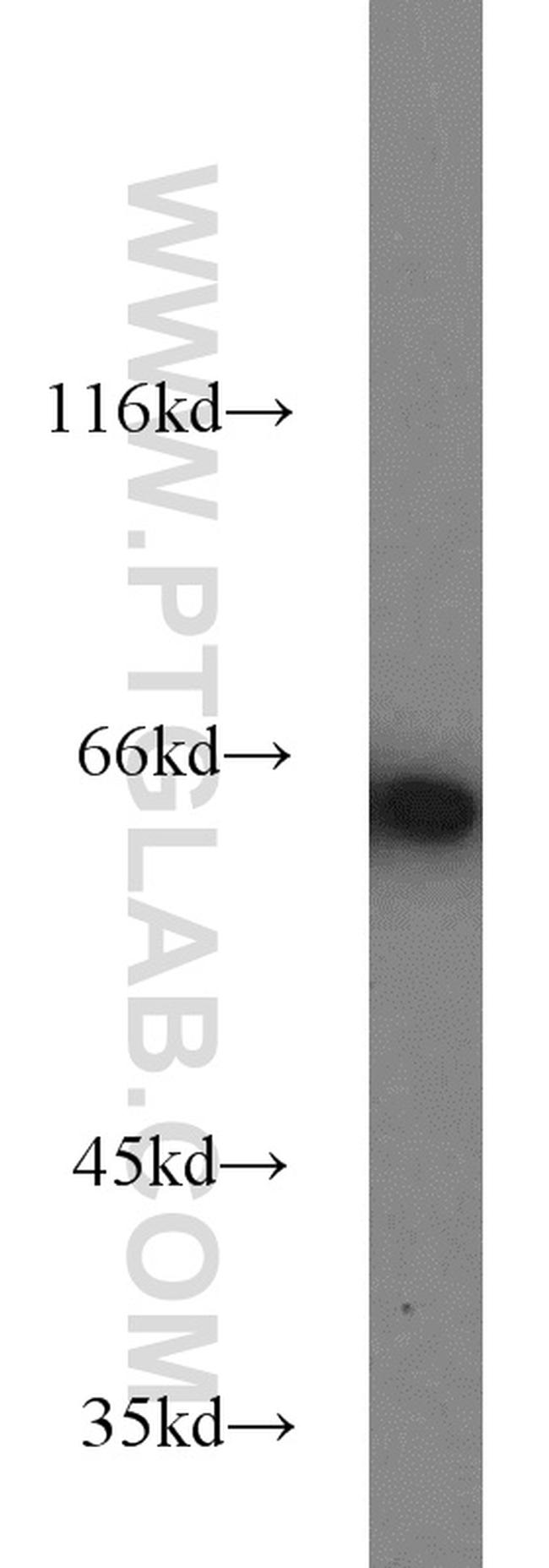 IGF2BP1 Antibody in Western Blot (WB)