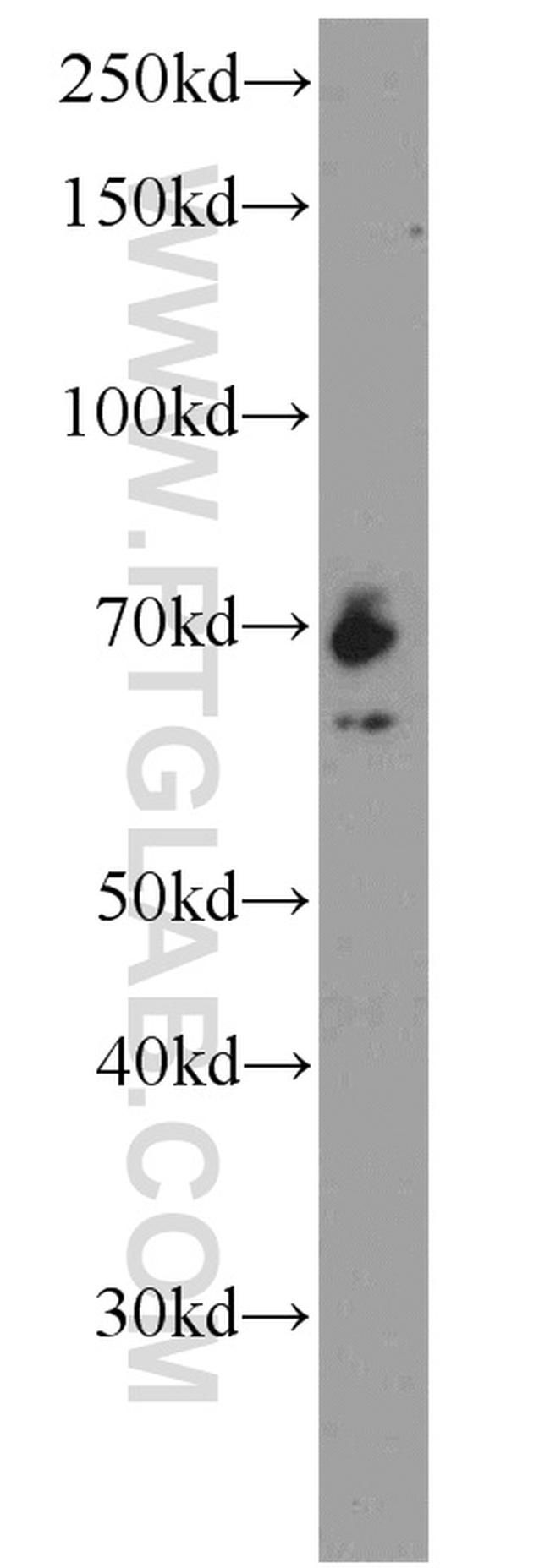 IGF2BP1 Antibody in Western Blot (WB)