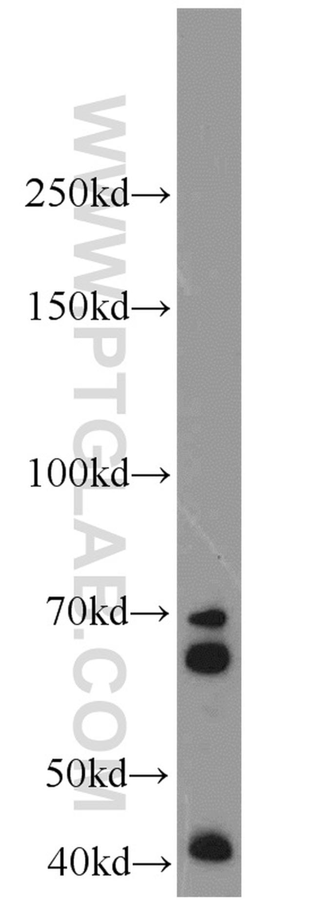 IGF2BP1 Antibody in Western Blot (WB)