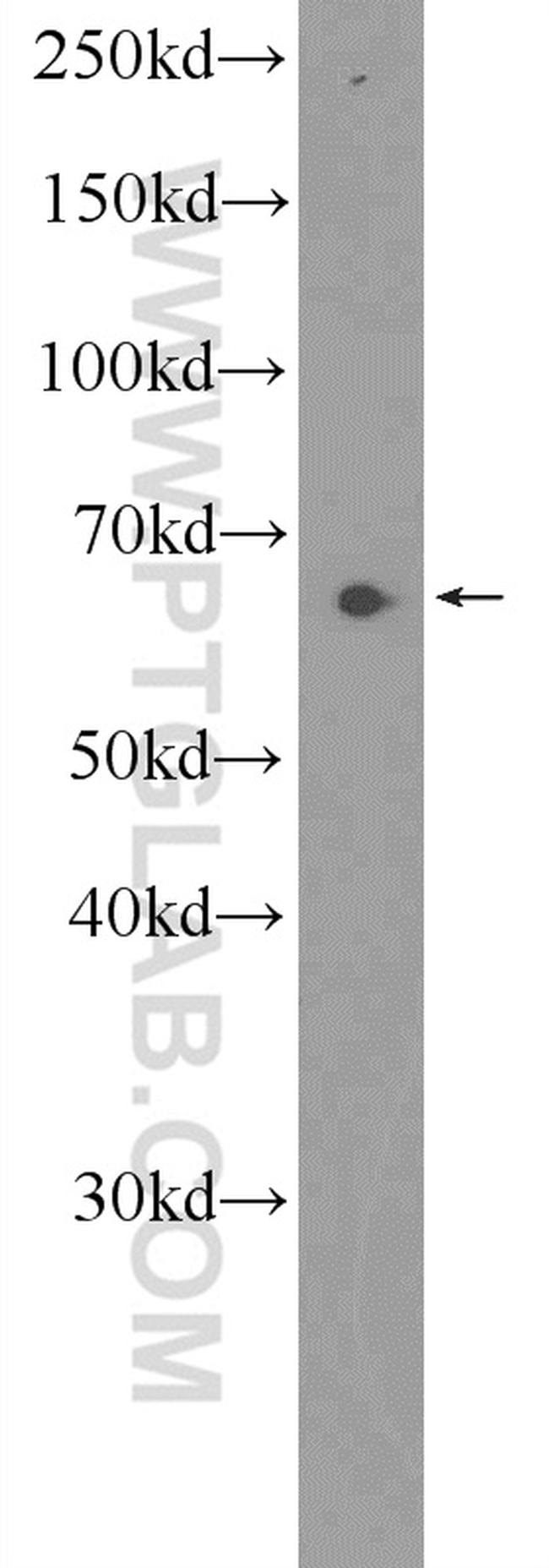 PRR14 Antibody in Western Blot (WB)