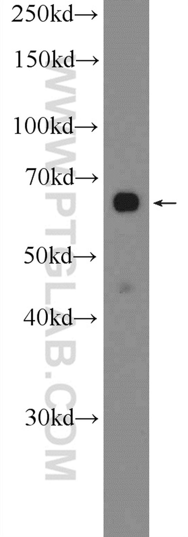 PRR14 Antibody in Western Blot (WB)