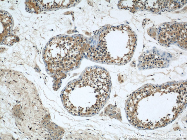 C7orf30 Antibody in Immunohistochemistry (Paraffin) (IHC (P))