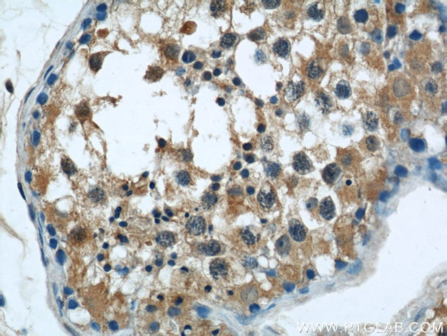 C7orf30 Antibody in Immunohistochemistry (Paraffin) (IHC (P))