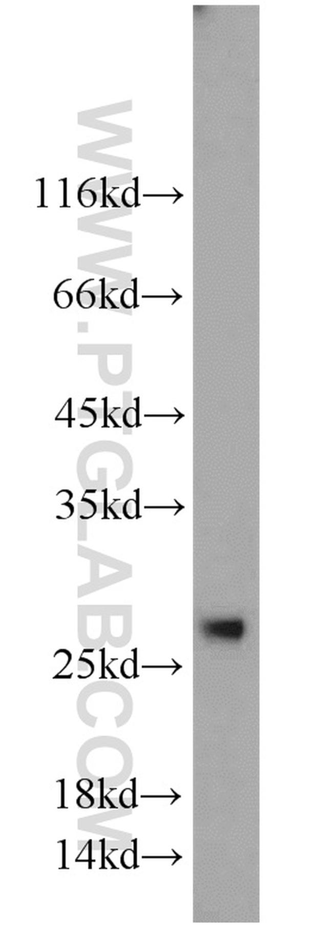 C7orf30 Antibody in Western Blot (WB)