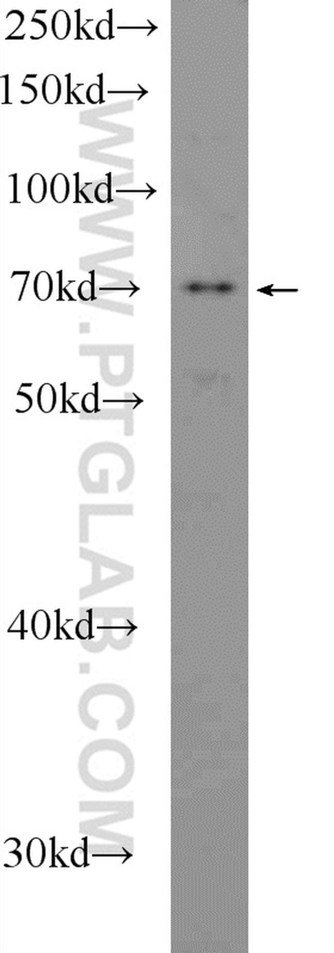 NO66/C14orf169 Antibody in Western Blot (WB)