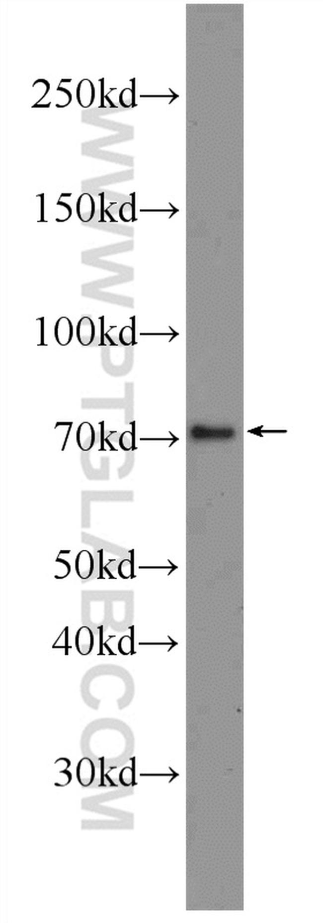 NO66/C14orf169 Antibody in Western Blot (WB)