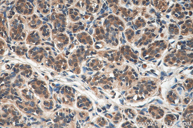 C1orf27 Antibody in Immunohistochemistry (Paraffin) (IHC (P))