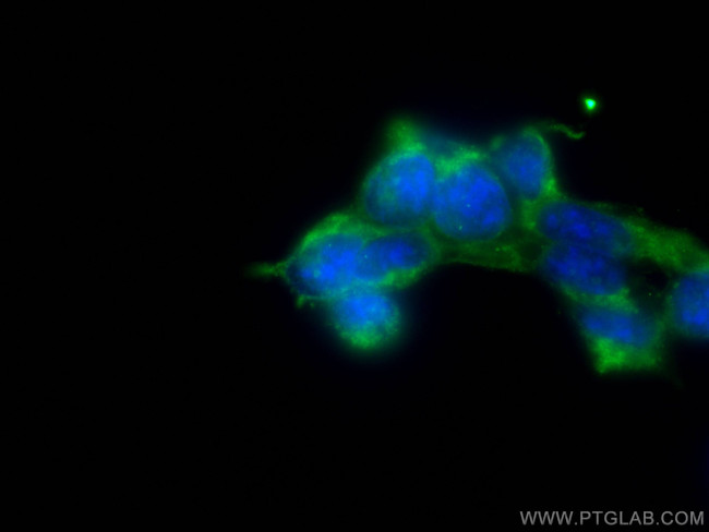 OFD1 Antibody in Immunocytochemistry (ICC/IF)