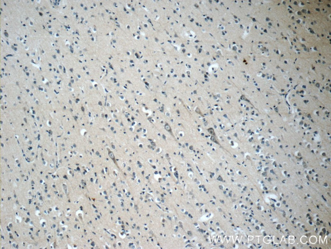 OFD1 Antibody in Immunohistochemistry (Paraffin) (IHC (P))