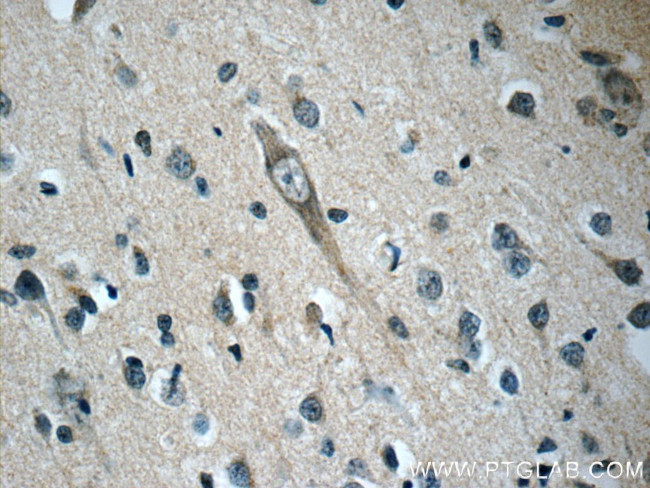 OFD1 Antibody in Immunohistochemistry (Paraffin) (IHC (P))