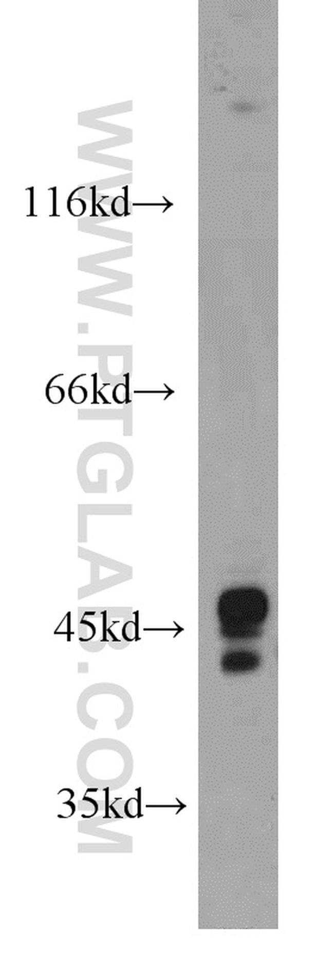 OFD1 Antibody in Western Blot (WB)