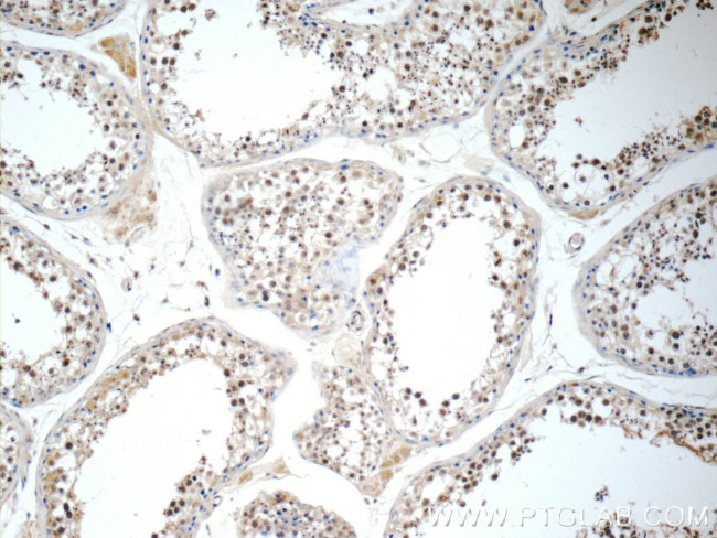 IL31 Antibody in Immunohistochemistry (Paraffin) (IHC (P))