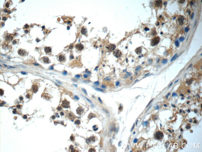 IL31 Antibody in Immunohistochemistry (Paraffin) (IHC (P))