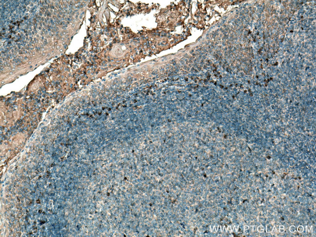 IL31 Antibody in Immunohistochemistry (Paraffin) (IHC (P))