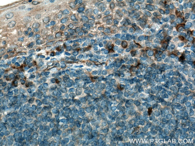 IL31 Antibody in Immunohistochemistry (Paraffin) (IHC (P))