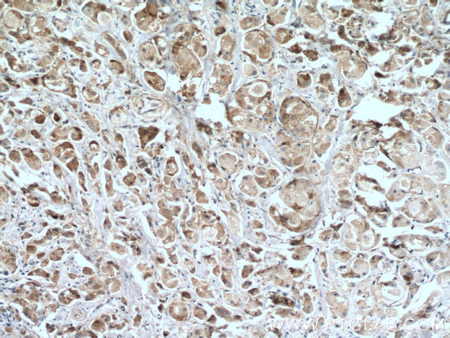 IL22RA2 Antibody in Immunohistochemistry (Paraffin) (IHC (P))