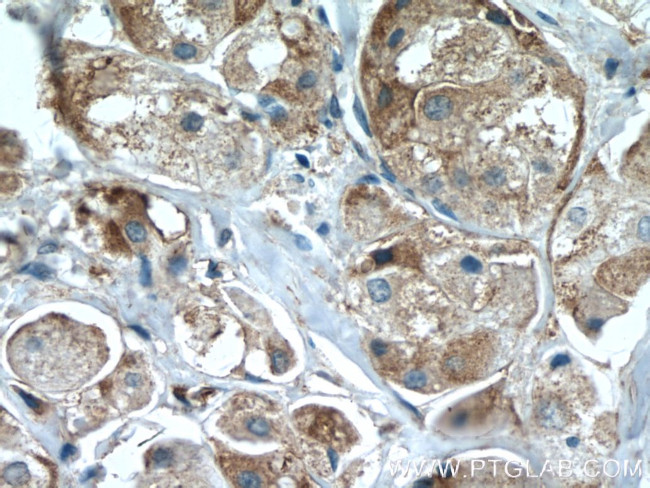 IL22RA2 Antibody in Immunohistochemistry (Paraffin) (IHC (P))