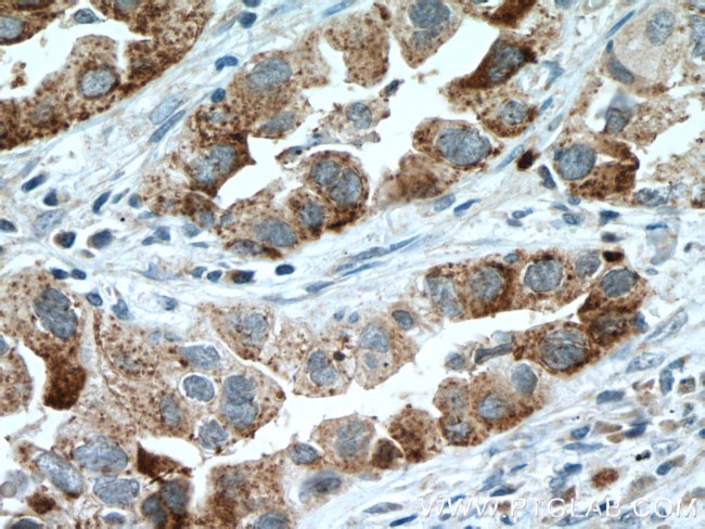 IL22RA2 Antibody in Immunohistochemistry (Paraffin) (IHC (P))