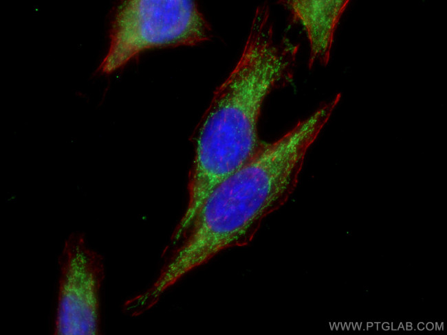 ACSM2A Antibody in Immunocytochemistry (ICC/IF)