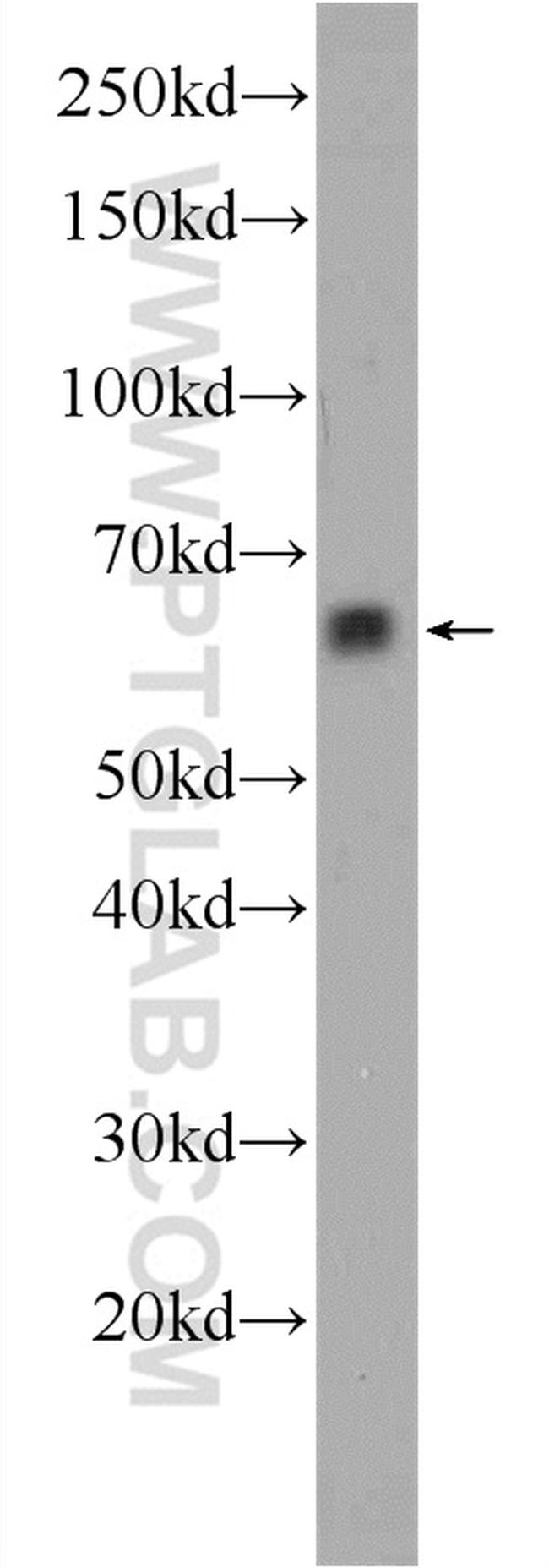 ACSM2A Antibody in Western Blot (WB)