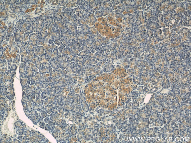 CSAD Antibody in Immunohistochemistry (Paraffin) (IHC (P))