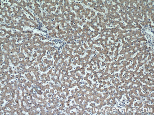 CSAD Antibody in Immunohistochemistry (Paraffin) (IHC (P))