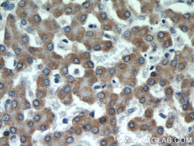 CSAD Antibody in Immunohistochemistry (Paraffin) (IHC (P))