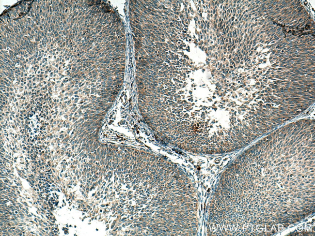 CSAD Antibody in Immunohistochemistry (Paraffin) (IHC (P))